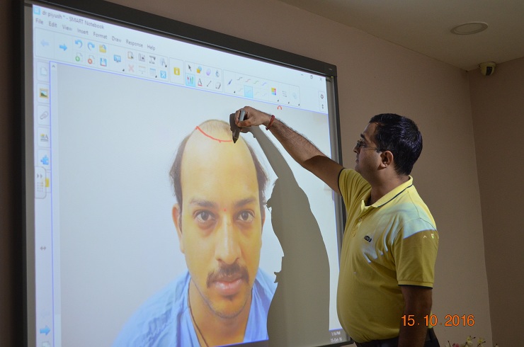 hair transplant training courses in india