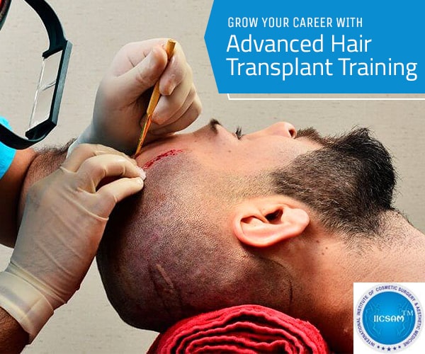 Become Versed with Advanced Hair Transplant Training | IICSAM