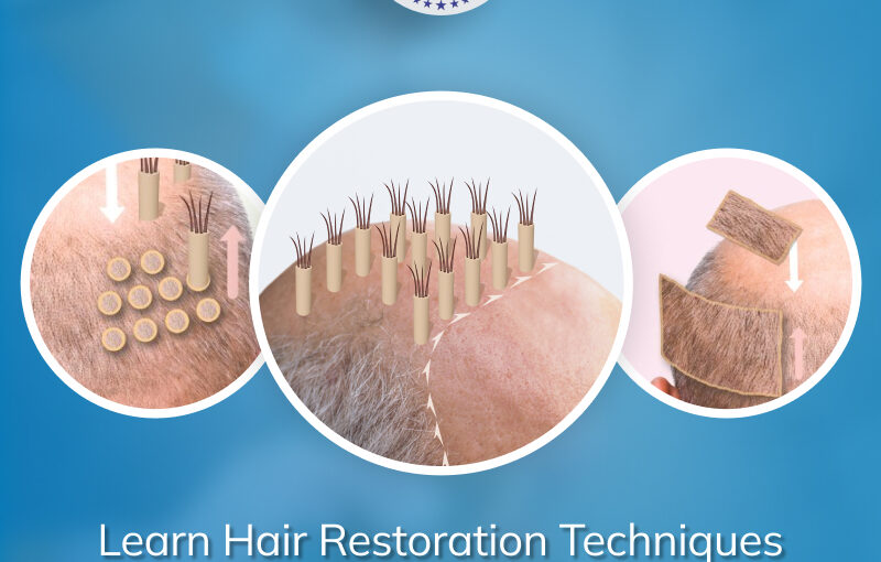 Hair Restoration Techniques You Learn in a Hair Transplant Training Course