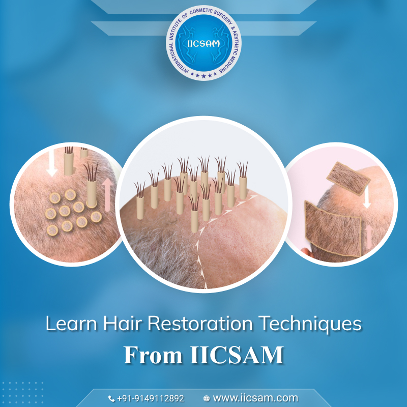 Hair Restoration Techniques You Learn in a Hair Transplant Training Course