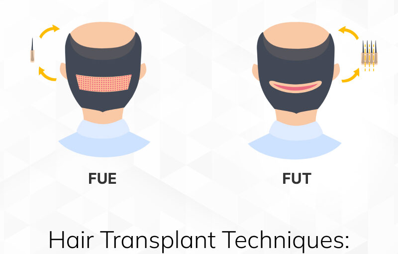 Give a Boost to Your Career with a Hair Transplant Training Course